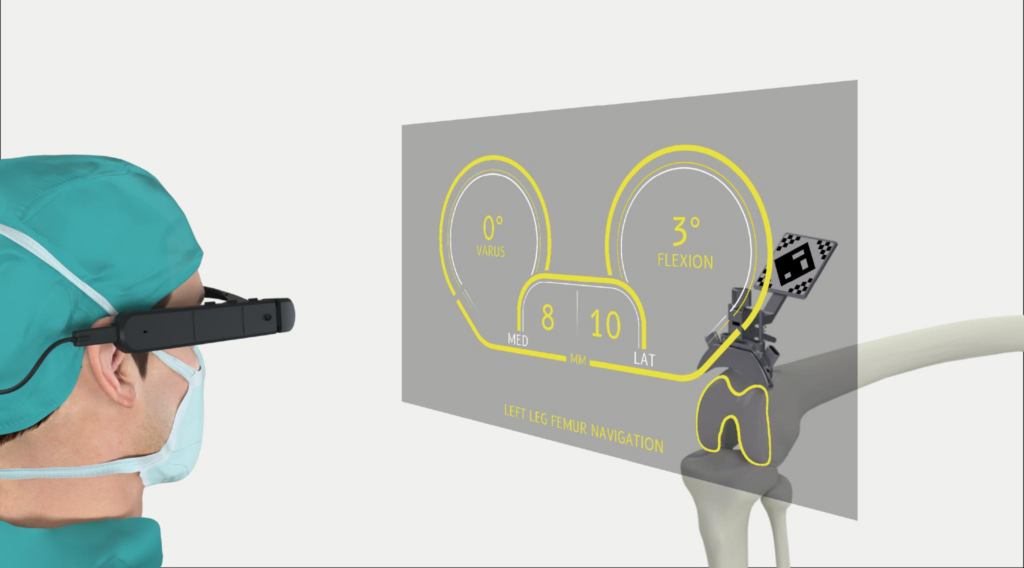 Pixee Medical Knee+ System